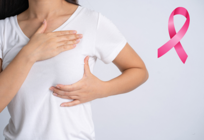 Cáncer de mama