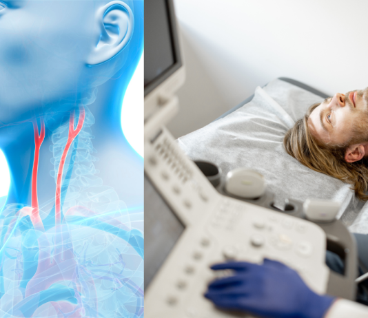 Carotidas