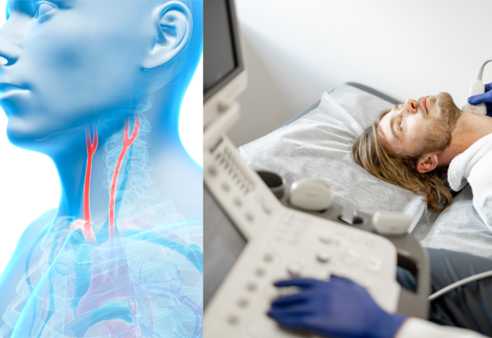 Carotidas
